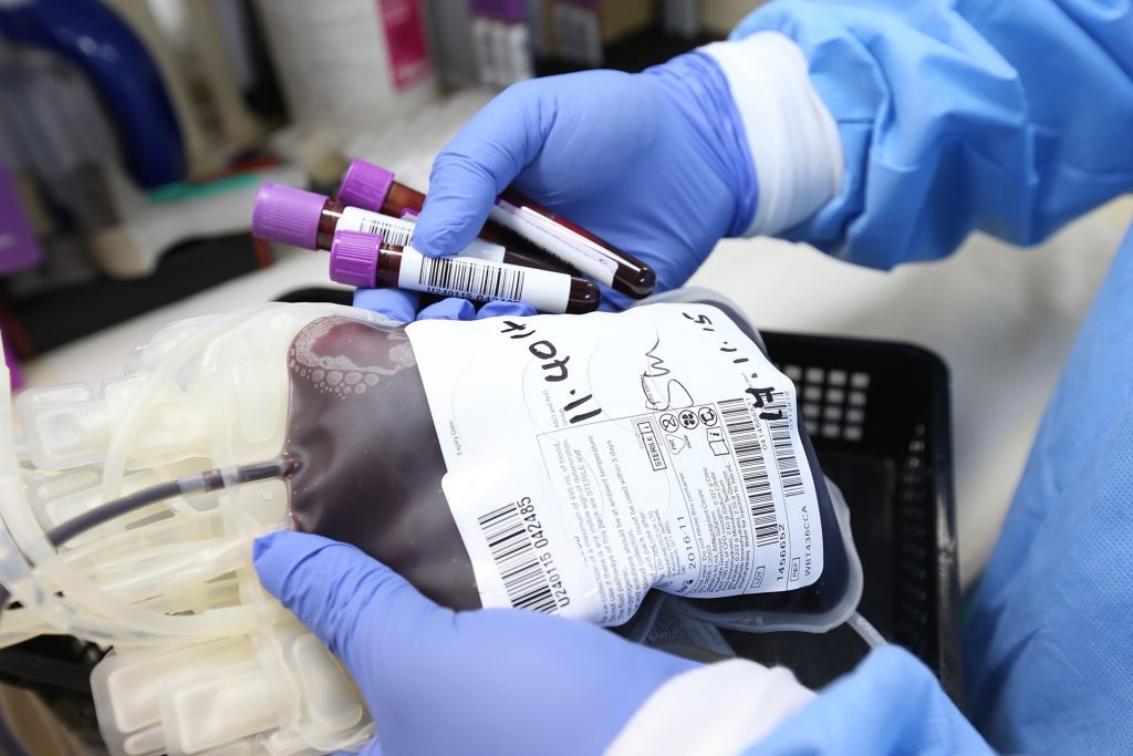 osoba w niebieskich rękawiczkach lateksowych i niebieskim fartuchu laboratoryjnym trzyma worek z krwią od dawcy i dodatkowo w prawej ręcej trzy probówki z krwią
