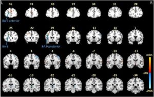obrazowanie mózgu metodą MRI, kolejne przekroje badanego mózgu