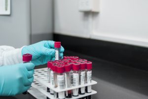 Ręce w niebieskich rękawiczka laboratoryjnych trzymają probówki z krwią nad stołem ze stojakiem z większą ilośćią probówek.